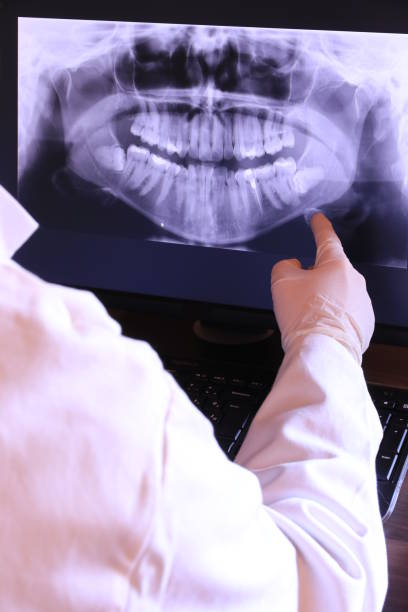Best Emergency Wisdom Teeth Removal in Lindenhurst, IL